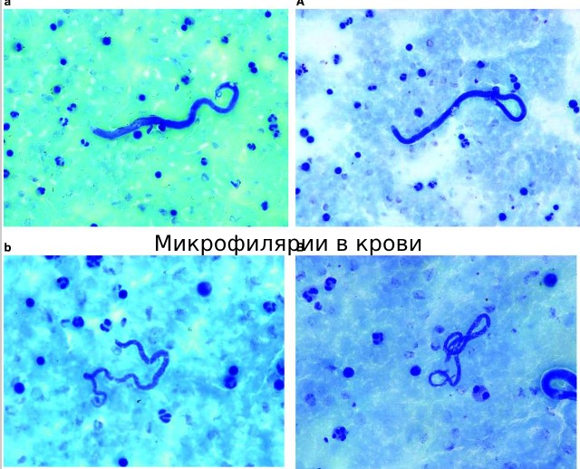 паразиты в крови