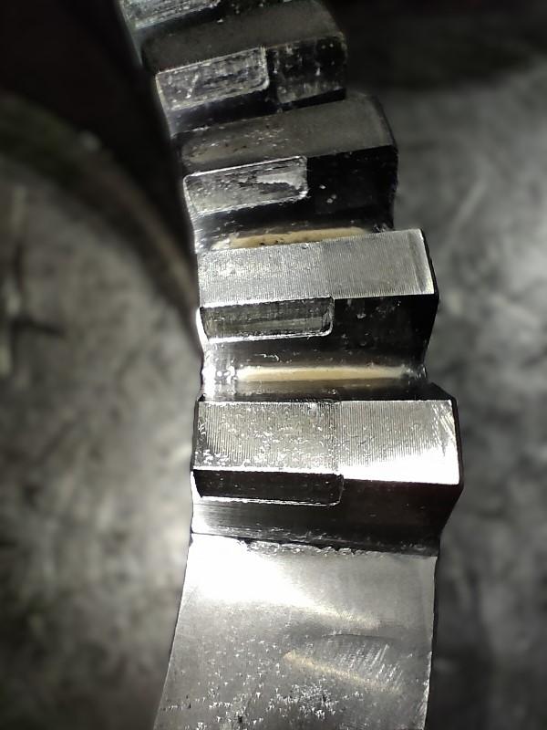 Повреждение зуба в зацеплении Хирта