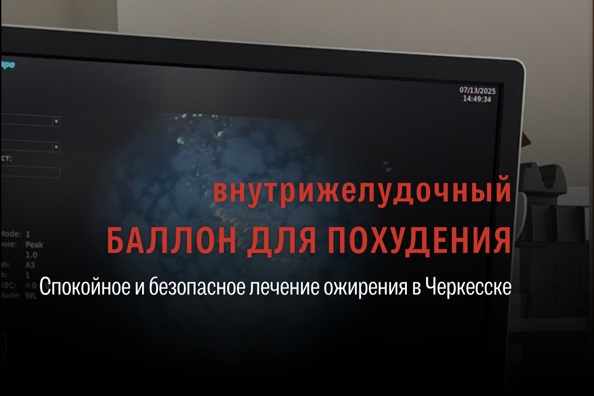Внутрижелудочный баллон для похудения в Черкесске: безопасное эндоскопическое лечение ожирения