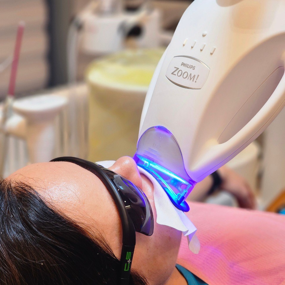 Отбеливание zoom 4