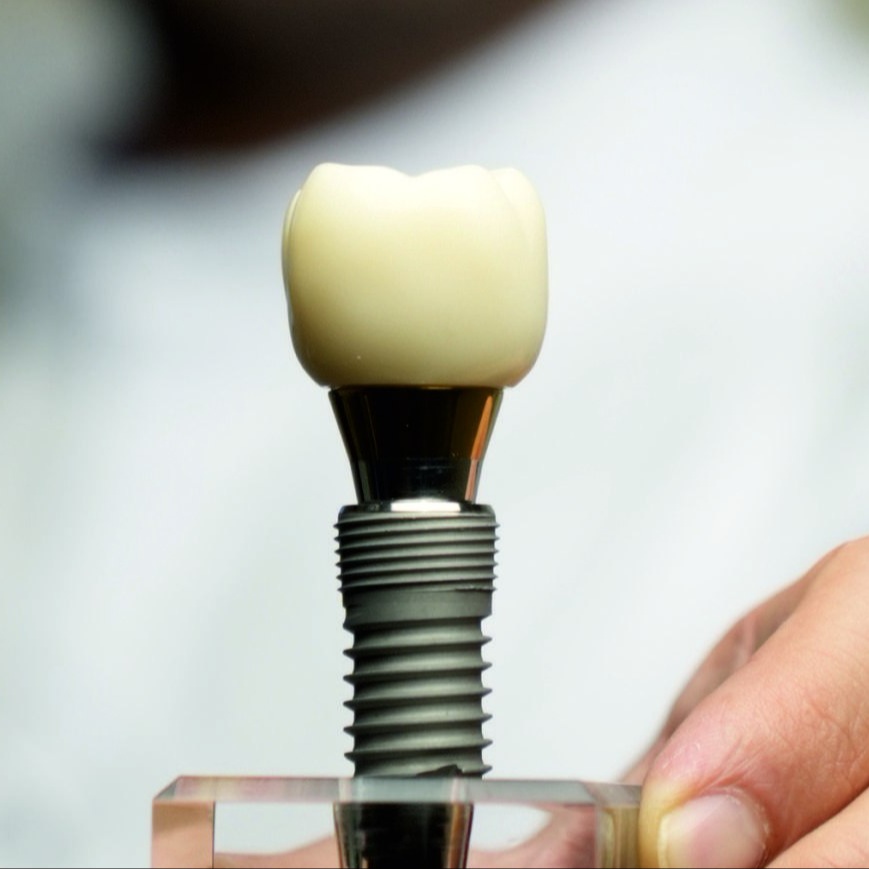 Отбеливание zoom 4