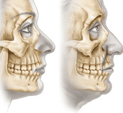 Анатомия лицевых костей