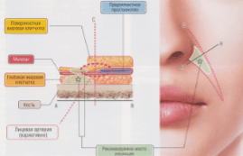Коррекция пространства Ристоу