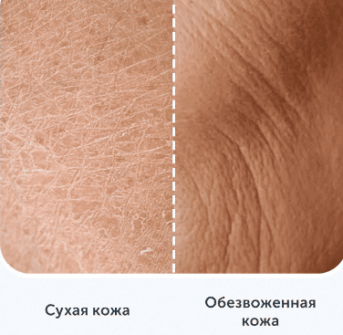 Схема проникновения гиалуроновой кислоты