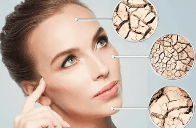 Пример обезвоженной кожи