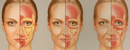 Возрастные изменения жировой клетчатки