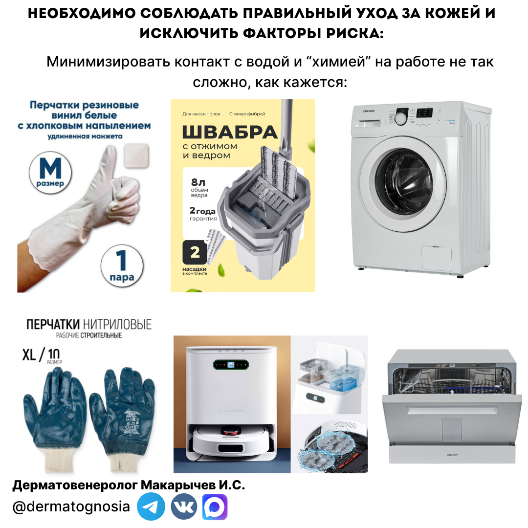Экзема кистей