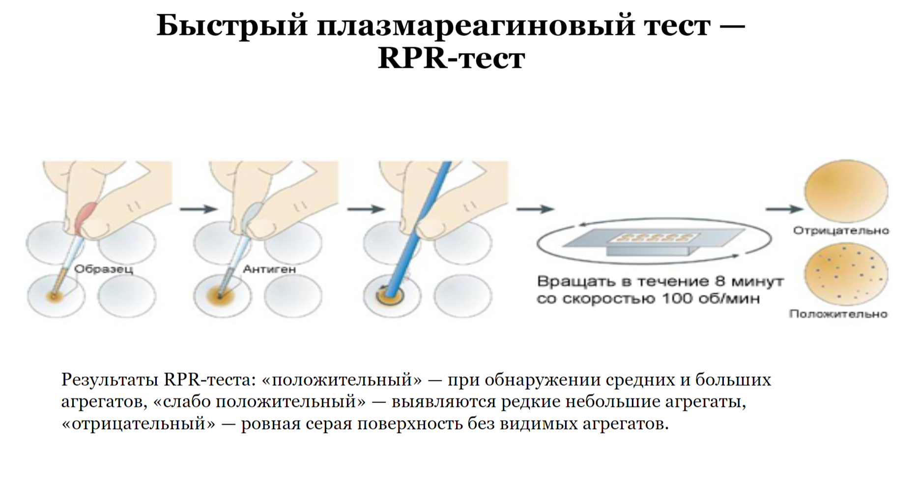 RPR тест сифилис как делают? 