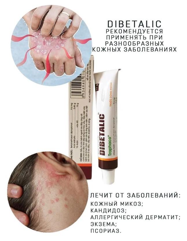 Мазь от грибов кандидоза экземы псориаза  Dibetalic