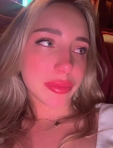 Возлюбленная Павла Дурова серьёзно травмировалась, упав с лестницы