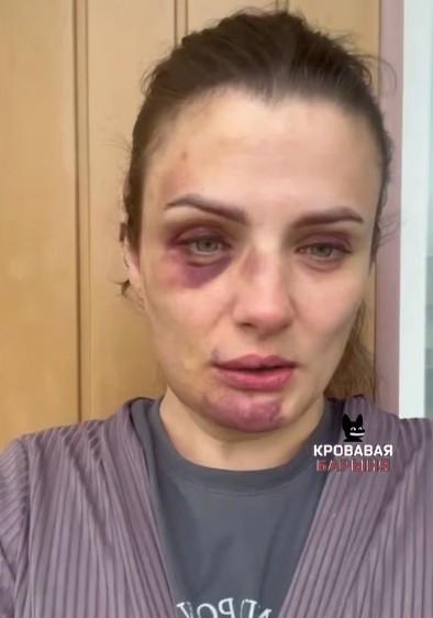 «Душил и кусал»: мать троих детей рассказала о пытках бывшего мужа в Калининграде