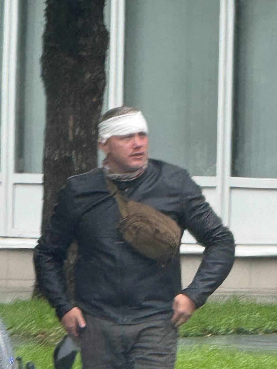Мужу "королевы марафонов" Блиновской разбили голову после аварии в центре Москвы