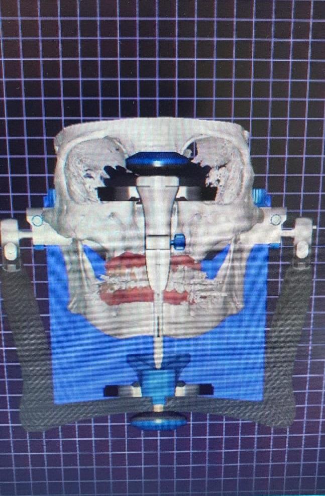double image fisrt part