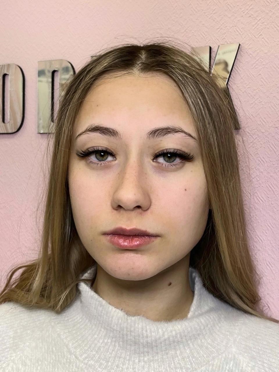 image alt