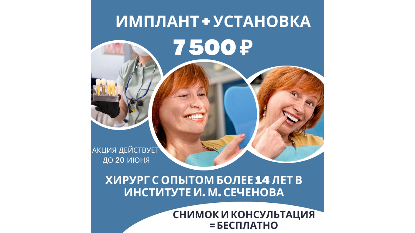 имплант + установка