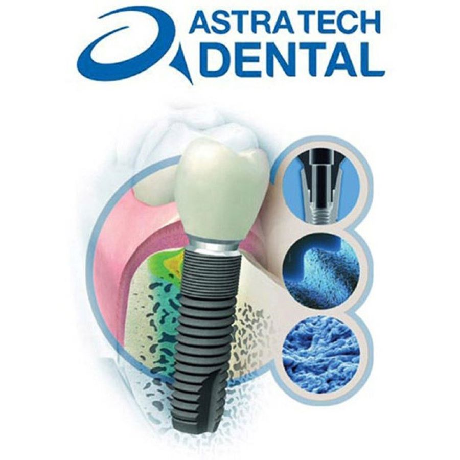 Astra tech Dental