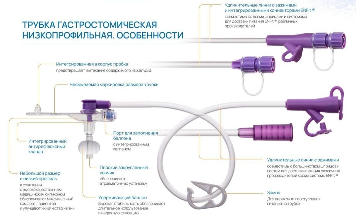 Гастростома низкопрофильная баллонная Mederen